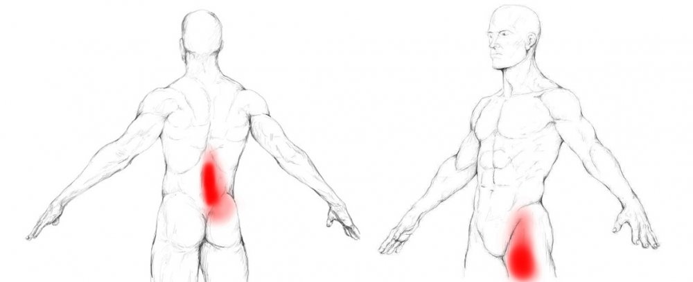 PHƯƠNG PHÁP TRỊ LIỆU CƠN ĐAU MÀNG CƠ THẮT LƯNG CHẬU (PHẦN 1)