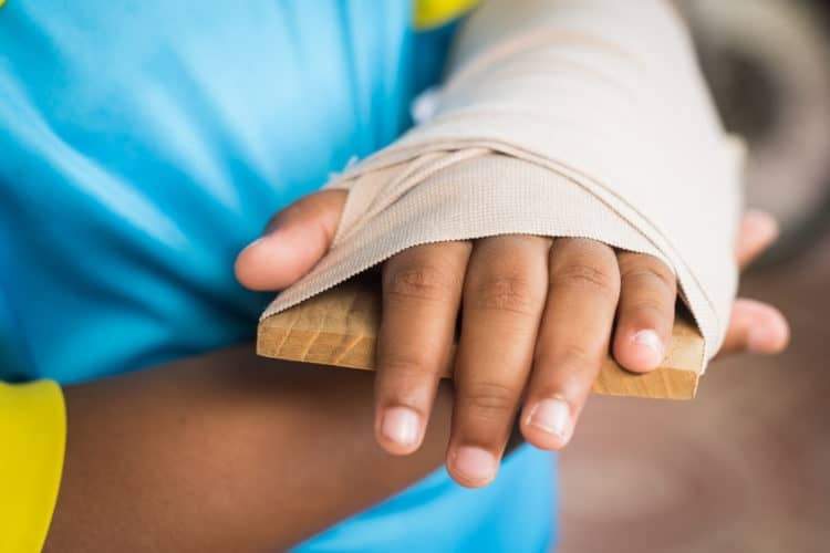 Cách sơ cứu người bị gãy tay