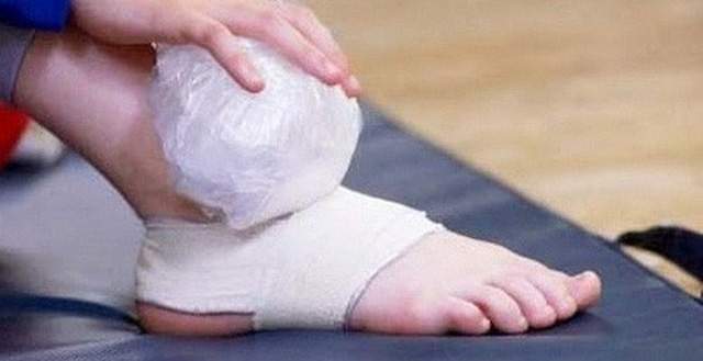 Cách sơ cứu nhanh khi bị bong gân