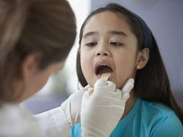 Viêm amidan ở trẻ em và những điều mẹ cần phải biết?