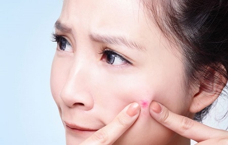 Cách trị mụn trứng cá bọc hiệu quả tại nhà