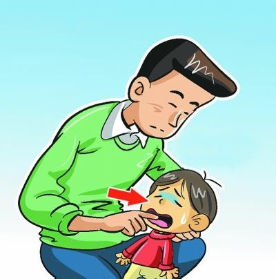 Cách sơ cứu khi trẻ bị hóc nghẹn mẹ phải biết