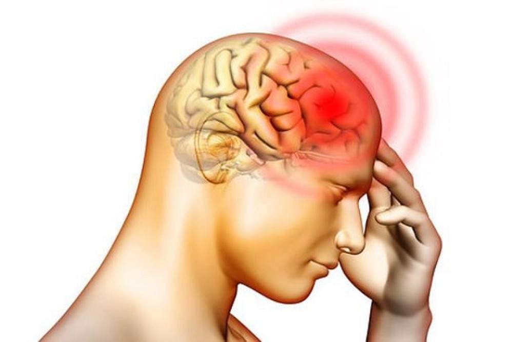 Các loại đau đầu thường gặp khiến bạn khó chịu - Tác hại của đau
