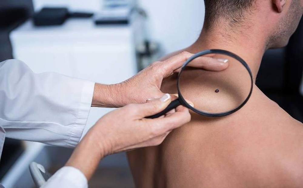 Dấu hiệu cảnh báo ung thư không thể bỏ qua ở nam giới